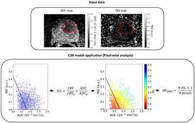 A DWI-based hypoxia model shows robustness in an external prostatectomy cohort